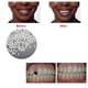 thumbnail image 1 of Reparación de encías con dientes sólidos Brackets caseros para dentaduras postizas Brackets de vampiro Brackets de tigre, 1 of 5
