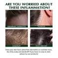 thumbnail image 3 of Champú limpiador antipicor de 100 ml Tratamiento anticaspa y seborreico para fortalecer el cabello y las raíces, 3 of 4