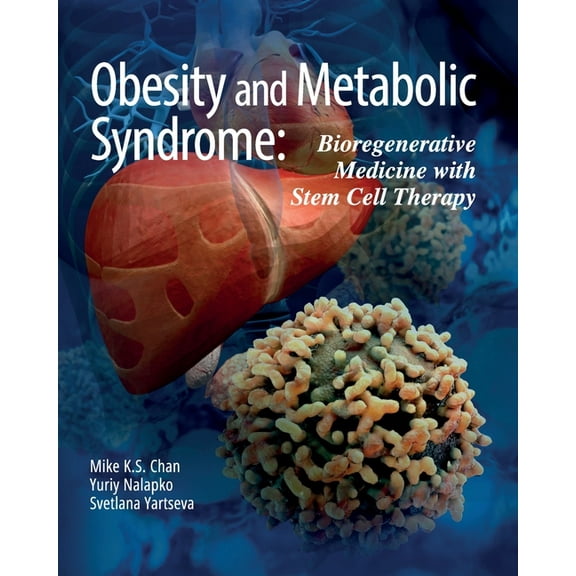 Obesity and Metabolic Syndrome: Bioregenerative Medicine with Stem Cell Therapy, (Paperback)