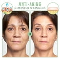 thumbnail image 4 of Set de Mascarilla Facial de Antocianinas - Limpieza Profunda, Hidratación, Eliminación de Puntos Negros - Blanqueador y Antienvejecimiento - Fórmula de Extracto de Frutas - Mascarilla Espumosa para, 4 of 5