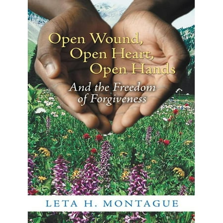 Open Wound, Open Heart, Open Hands - eBook