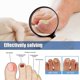 thumbnail image 5 of 60pcs Toenail Fungus Treatment Stickers Ingrowning Toenail Nail Repair Patch, 5 of 5