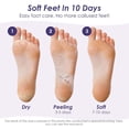thumbnail image 2 of Upgraded 2026 Peeling Foot Mask Exfoliating Foot Mask Socks Baby Feet Mask 1 Pair 38ml, 2 of 6