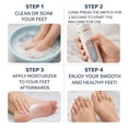 thumbnail image 3 of Electric Foot File, Automatic Callus Remover, Portable Pedicure Device with One-Button Control, Rechargeable & Replaceable Heads, for Cracked Heels & Dead Skin, Men & Women, Christmas Gift, 3 of 11