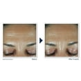 thumbnail image 4 of RoC Retinol Correxion Deep Wrinkle Filler for Fine Lines and Anti-Aging, 1.0 fl oz, 4 of 13