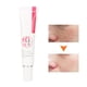 thumbnail image 5 of 25 g Crema blanqueadora para atenuar pecas Crema hidratante con colágeno para eliminar manchas, 5 of 10