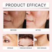 ONLYEOR Hyaluronic Acid Toner, Sakura Hyaluronic Acid Boosting Essence, Hyaluronic Acid Serum, Ultra Hydrating Facial Moisturizer for Hydration, Tightening, Anti Aging, Instant Glow 120ml