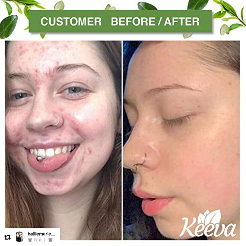 tea tree oil good for scars