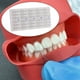 thumbnail image 3 of 30 Piezas De Carillas Dentales, Herramienta De Blanqueamiento De De Plástico De Grado Alimenticio Rápido Rápido Sunnimix  Carillas de belleza dental, 3 of 8