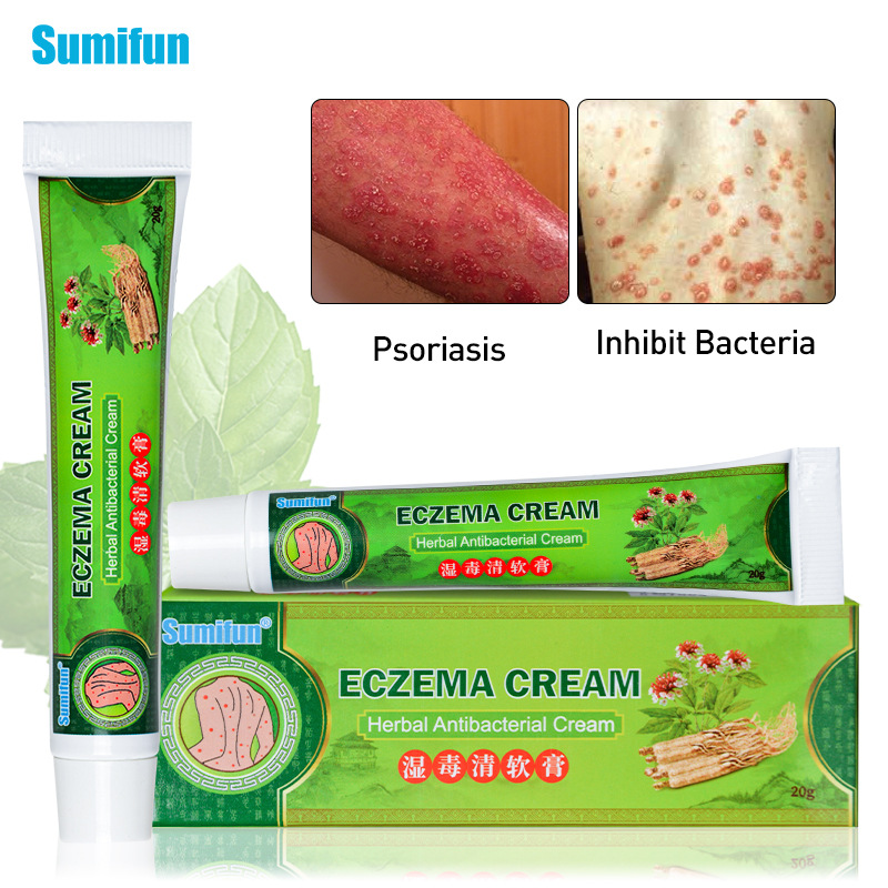 Buy Eczema Cream, Dry Skin, Eczema Treatment , Calendula Cream