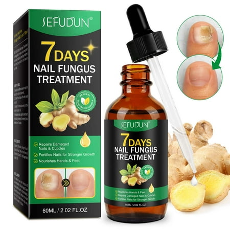 Nail Treatment, 7-Day Nail Fungus Treatment, Nail Repair & Strengthen Cuticles, 2.02 FL.OZ