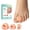 Beige, variant on Welnove 12 Pcs Toe Separators for Overlapping Toes - Toe Spacers For Bunions, Hammer Toes - Toe Corrector to Realign Crooked Toes, Medium, Beige