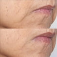 thumbnail image 2 of Perricone MD Cold Plasma Plus+ The Intensive Gel Mask, 2 fl. oz., 2 of 4