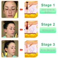 thumbnail image 4 of Wentin Reduce Creams Moisturizers Purifying Exfoliating Gel Exfoliating Scrub Moisturizing Cleanses Skin Give Deep Cleansing And Body Exfoliating Scrub Gel For Various Skin Types, 4 of 8