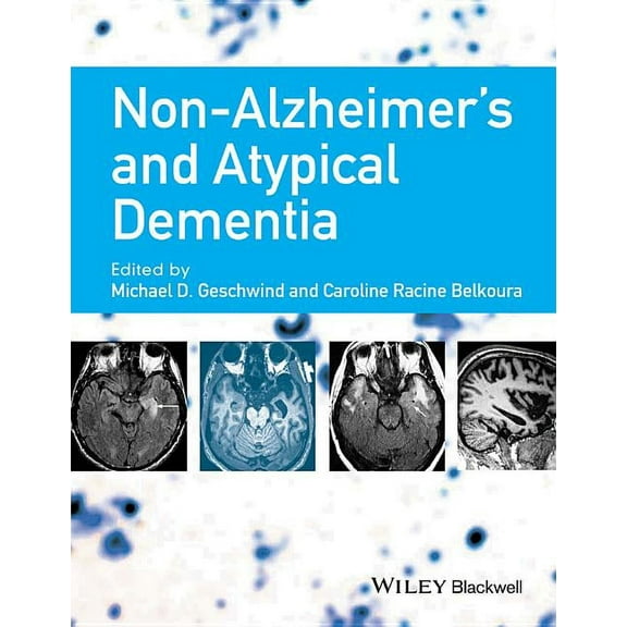 Non-Alzheimer's and Atypical Dementia, (Hardcover)