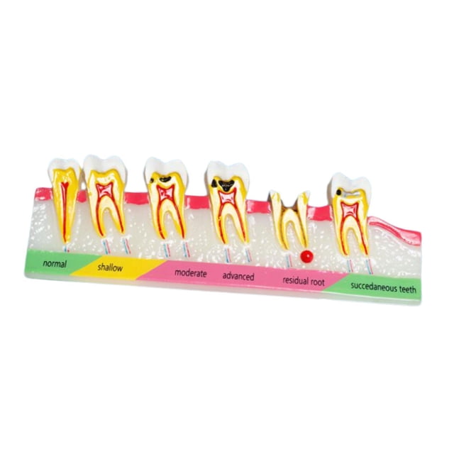 lionlar Demonstration Tooth Model Education Standard Tooth for School Classroom Kids A