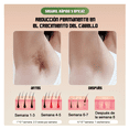 thumbnail image 2 of Depiladora De Pulsada Permanente Láser Facial Y Corporal Belug, blanco, 2 of 5