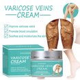 thumbnail image 2 of Crema para varices SXIAGNIAN Crema para varices Alivio de la inflamación Tratamiento de venas varicosas Crema para el cuidado de las piernas 50 g, 2 of 9