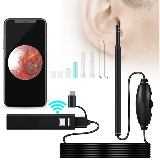 Ear Otoscope, HD Visual Ear Endoscope Camera with 6 LED Dimmable Light, Adults Kids Pets Ear Cleaning Kit for Android, Tablet and PC
