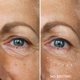 thumbnail image 2 of Crema reductora de arrugas en suero para debajo de los ojos WUNDER2 WUNDERLIFT, 2 of 7