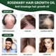 thumbnail image 3 of Pack de 2 Aceites de Romero para Estimular el Crecimiento y Nutrir el Cabello, 30ml, 3 of 7
