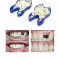 thumbnail image 3 of temporary denturesg, 3 of 4