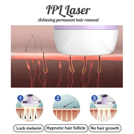 painless epilator ipl