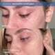 thumbnail image 3 of Bálsamo para aliviar el eccema Skinfix Eczema+ Dermatitis 50 ml, 3 of 6