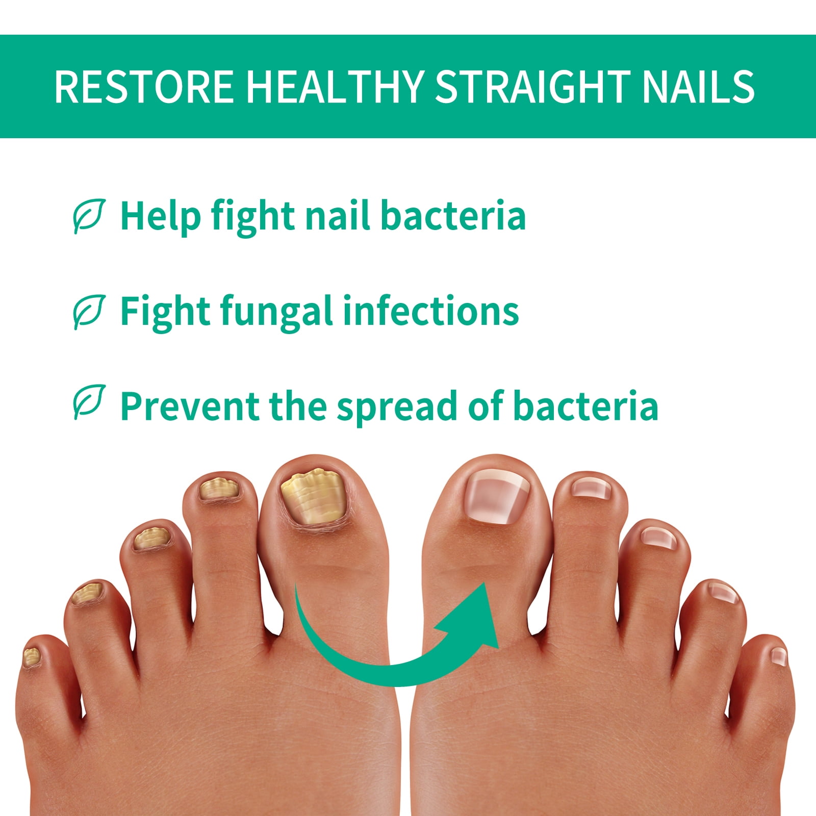 Alvantor Toenail Fungus Treatment for Damaged Nails, Moisturizing & Brightening Serum for Hands, Feet & Toenails, 0.34fl oz
