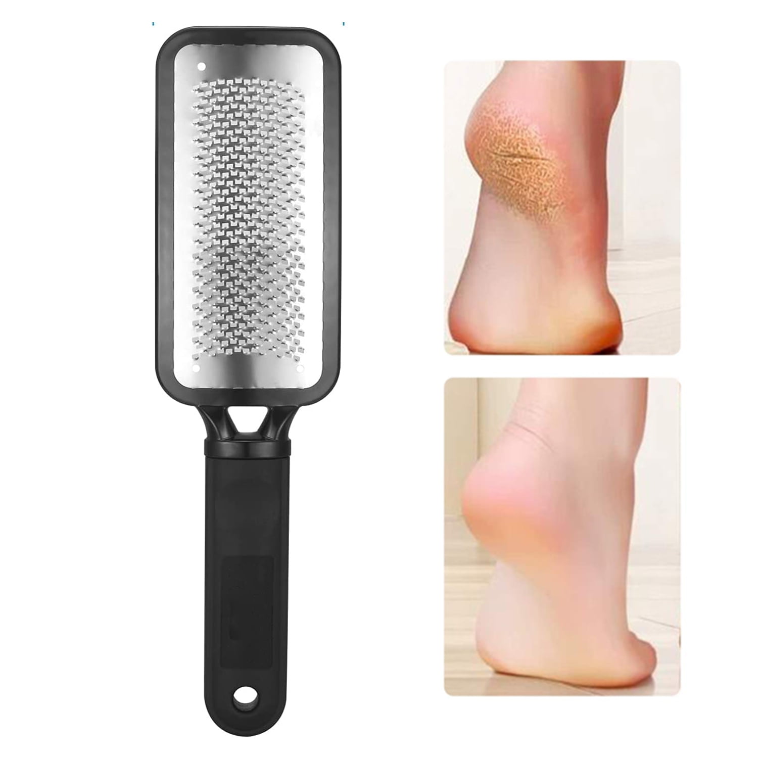 Nylea Foot File Callus Remover - Stainless Steel Foot Rasp to Remove Hard Skin - Black