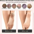 thumbnail image 5 of Foot File -dead Skin Remover -foot Rasp For Exfoliation - Softening Feet -pedicure Tool For Foot Care, 5 of 5