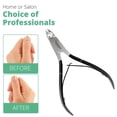 thumbnail image 3 of Professional Cuticle Trimmer Nail Cuticle Cutter Stainless Steel Cuticle Nippers with Sharp Blades of Cuticle Remover Clippers Manicure Tools Double Spring - Pedicure Nail Tools (Black - 4 Pack), 3 of 7