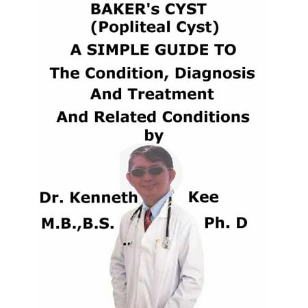 Baker’s Cyst, (Popliteal Cyst) A Simple Guide To The Condition, Diagnosis, Treatment And Related Conditions -