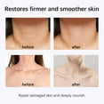 thumbnail image 4 of Tightening Neck Texture Patch Lifting And Firming Neck Care Weakening Neck Texture Cream 150g, 4 of 6