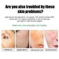 thumbnail image 5 of Crema para eliminar acné y manchas/manchas aclaradoras y piel brillante/crema hidratante para el cuidado de la piel manchas y manchas de acné, 5 of 5