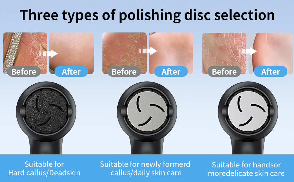 NaTuGi Electric Vacuum System IPX6 Waterproof Removes Hard Cracks Dryness Dead Skin Corn and Callus Trimmer for Feet