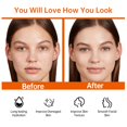 thumbnail image 4 of Set de cuidado facial HONLINK con vitamina C y niacinamida, 8 piezas, 4 of 9