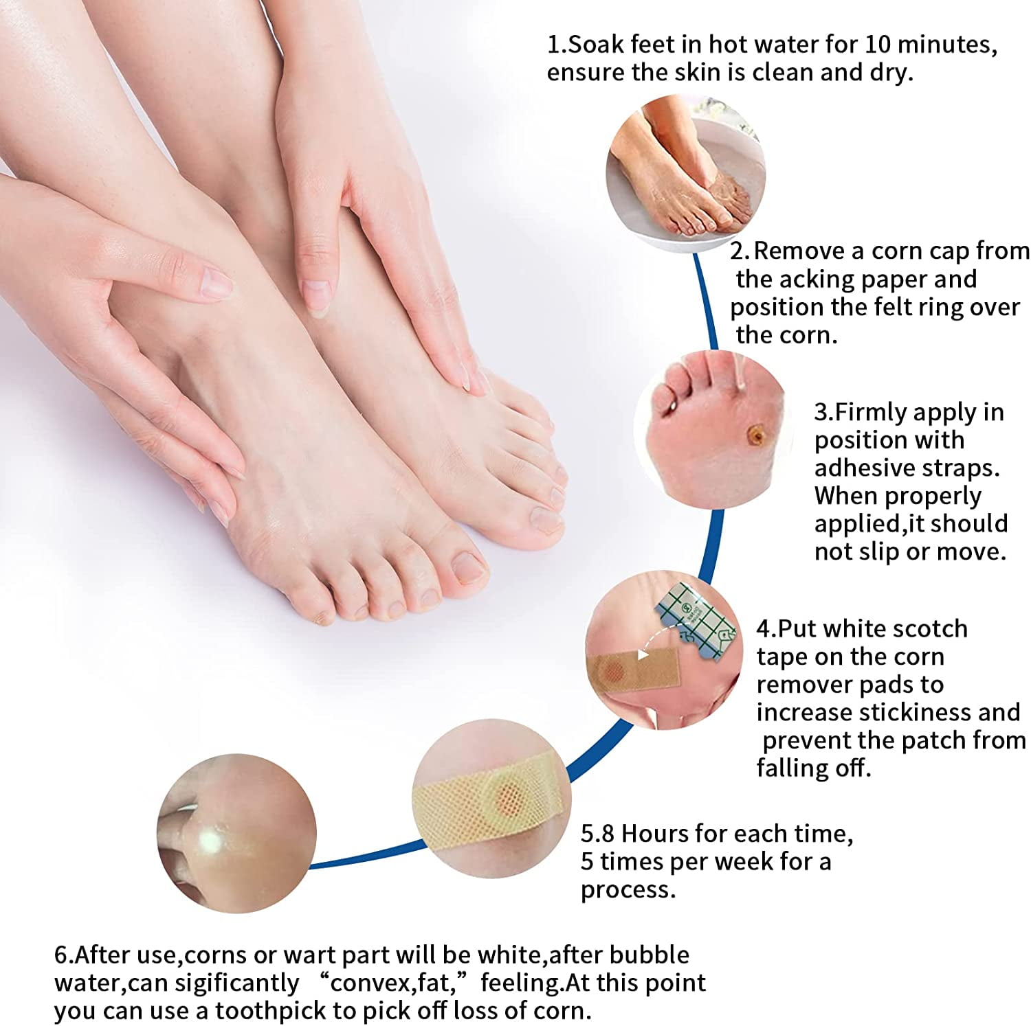 Callus Removal At Home: 5 Top Tips - Northwich Foot Clinic
