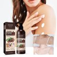 thumbnail image 4 of Cold White Skin All Over, Cold White Full Systemic Whitening Cream, Whitening System Mask Milk Whole Body Cold White Skin Body Lightening Cream,Inner Thigh 100g, 4 of 9