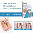 thumbnail image 4 of Nail Repair and Care Spray for Hands, Feet, and Nails - Strengthens, Cleans, and Polishes - 100ml, 4 of 5