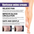thumbnail image 4 of Pomada para venas varicosas, reparación de venas varicosas y vasculitis, 4 of 5