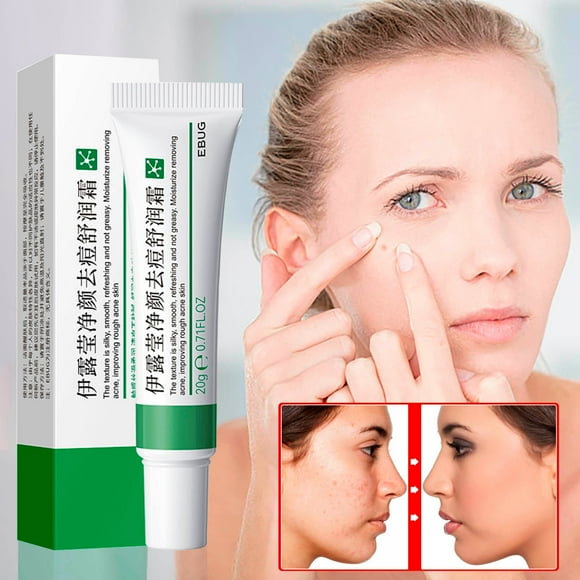 TopLLC Clear Face And-relieving Cream Fade Marks Water And Oil Removing Cream 20g a Cream