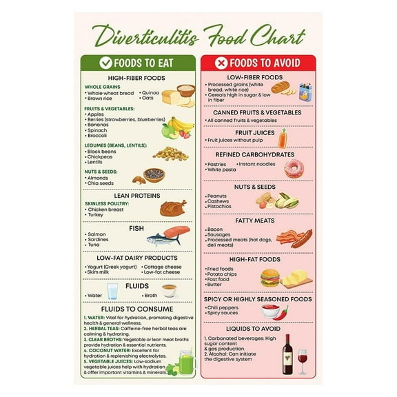 Diverticulosis Diet Food Chart Poster Diverticulitis Poster, Good for Digestion, Digestive Gut Health Diet Guide Grocery List (Diverticulosis Diet Food List)