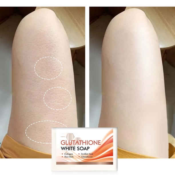 food glutathione Key Benefits of Glutathione for Detox and Skin Health food glutathione Key Benefits of Glutathione for Detox and Skin Health