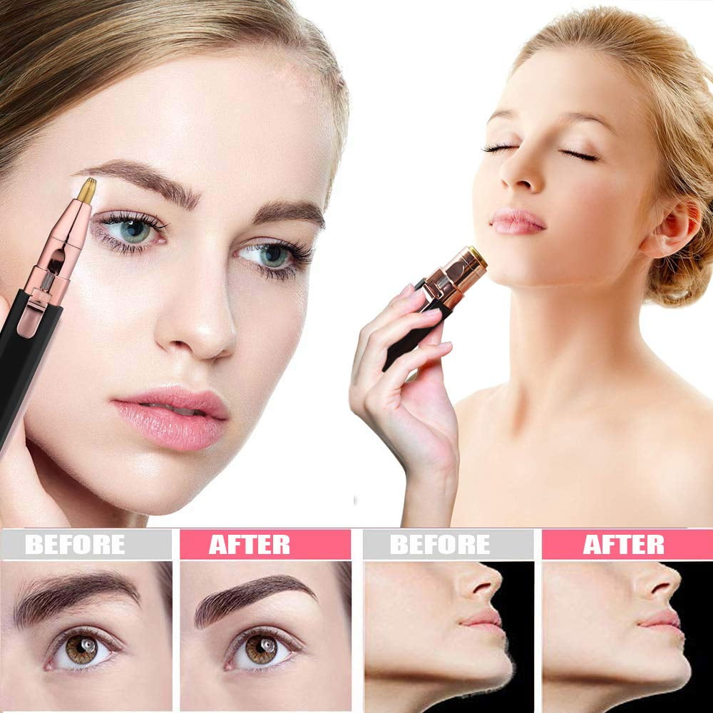 female facial hair removal