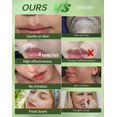 thumbnail image 4 of Crema de depilación facial Zeponyx Painless para mujeres, 4 of 7