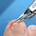 thumbnail image 2 of Nail Clippers, Designed for Ingrown and Thick Nails, Portable Sharp Stainless Steel Nail Clippers, 2 of 4