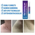 thumbnail image 4 of Yeso De Eliminación De Verrugas Crema de tratamiento corporal para eliminación de verrugas, removedor de marcas en la piel, yeso medicinal a base de hierbas Ndcxsfigh Cuidado Belleza, 4 of 8