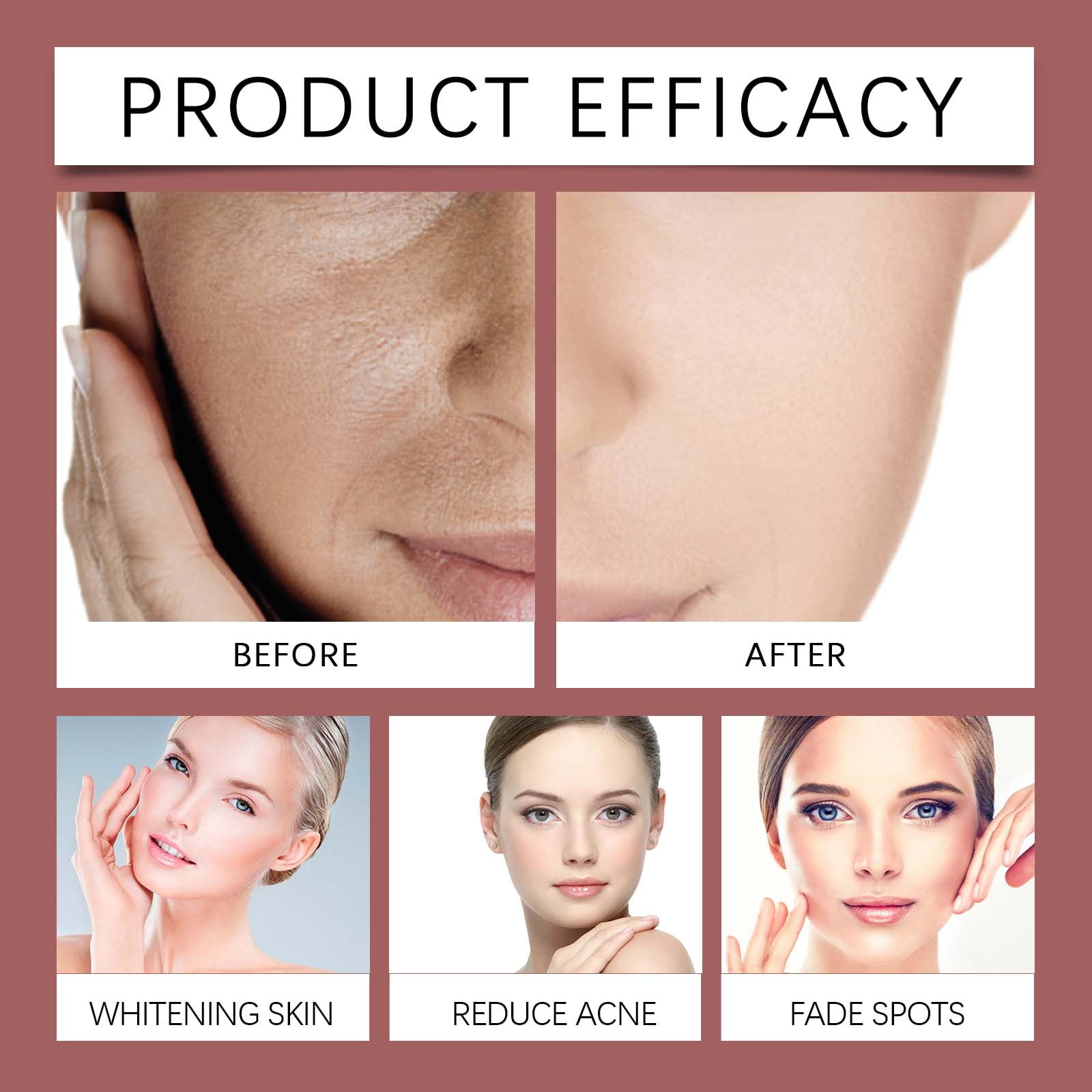Alvantor Brightening Face Serum with Salicylic Acid and Rosemary Extract, 1 fl oz