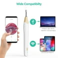 thumbnail image 5 of Digital Otoscope WiFi Earpick Camera Visual Endoscope, Ear Scope with 19 Ear Cleaner Tools for iOS, Android - 100E, 5 of 5